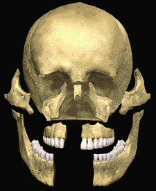 3Dtrauma 3Dtrauma